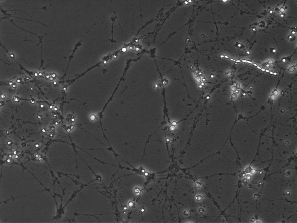 Primary Rat Neurons in Adherence - 48 hrs post EP - Viability 100 per cent x 2